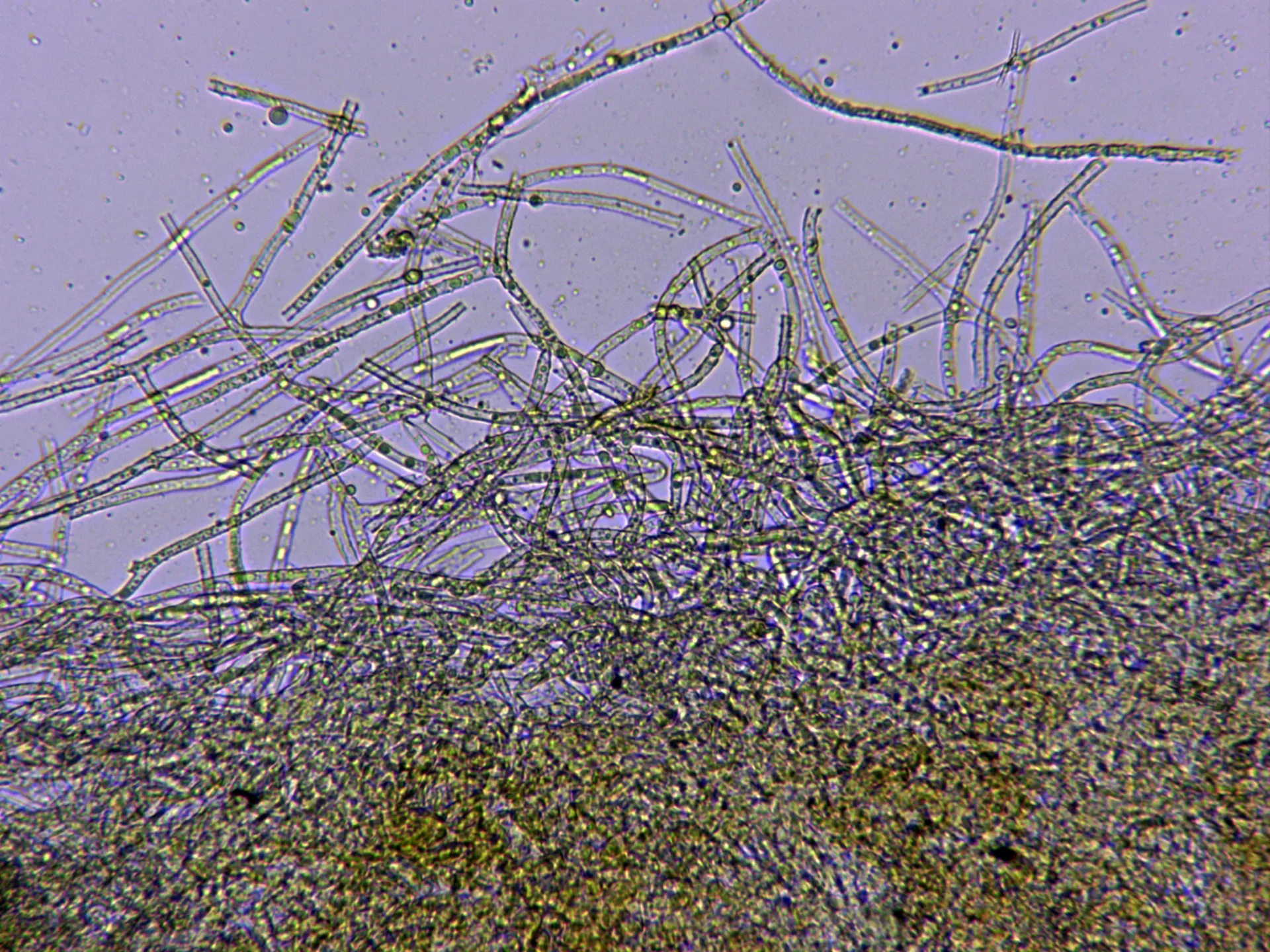 Microscopía de Piloderma bicolor - 10 - Base agua x 400